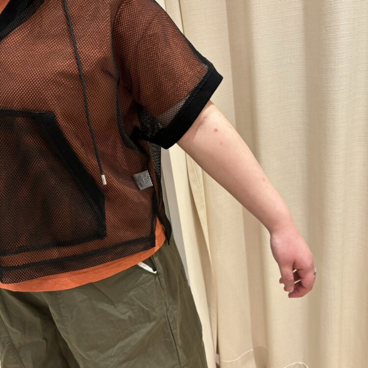 S__8544267_0